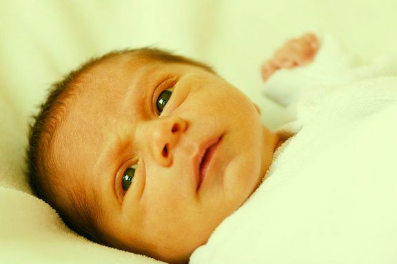 Jaundice in babies