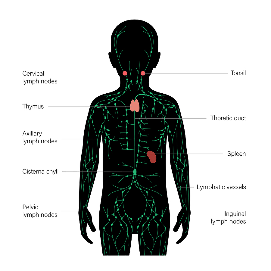 Lymphadenitis